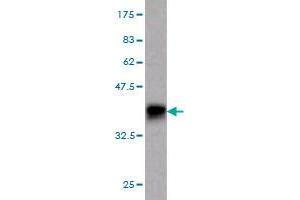 Western Blot detection against Immunogen (37. (GUCY2C 抗体  (AA 24-133))