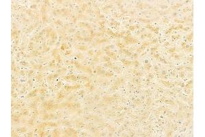 ABIN6261955 and ABIN6278574 at 1/100 staining human normal liver tissue by IHC-P.