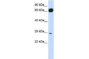 WB Suggested Anti-PRTFDC1 Antibody Titration:  0. (PRTFDC1 抗体  (N-Term))