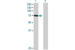 Western Blot analysis of PKP1 expression in transfected 293T cell line by PKP1 MaxPab polyclonal antibody. (Plakophilin 1 抗体  (AA 1-726))