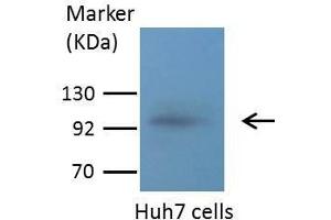 WB Image Sample (30 ug of whole cell lysate) A: A431 , B: H1299 7. (MMP 9 抗体)