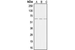 Western blot analysis of AGBL4 expression in HepG2 (A), Jurkat (B), HeLa (C) whole cell lysates. (AGBL4 抗体  (C-Term))