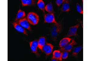 Immunocytochemistry staining of vesicles (red) in RBL-2H3 rat basophilic leukemia cell line using anti-Kinesin (KN-02). (Kinesin (heavy chain) 抗体)