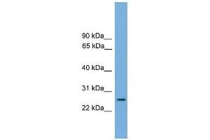 RAB35 antibody used at 0. (RAB35 抗体  (Middle Region))