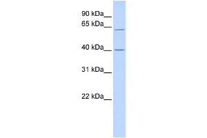 WB Suggested Anti-TRIT1 Antibody Titration:  0. (TRIT1 抗体  (Middle Region))