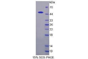 SDS-PAGE analysis of Cow CSN3 Protein. (CSN3 蛋白)