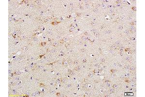 Formalin-fixed and paraffin embedded rat brain tissue labeled with Anti Phospho-TrkA (Tyr674/675) /TrkB (Tyr706/707) Polyclonal Antibody, Unconjugated (ABIN746618) at 1:200 followed by conjugation to the secondary antibody and DAB staining. (TRKA 抗体  (pTyr680, pTyr681))