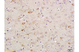 Immunohistochemistry (IHC) image for anti-Neurotrophic Tyrosine Kinase, Receptor, Type 1 (NTRK1) (pTyr680), (pTyr681) antibody (ABIN746618)