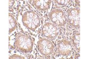 Immunohistochemistry of CD248 in human colon tissue with CD248 polyclonal antibody  at 2. (CD248 抗体  (N-Term))