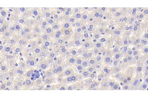 Detection of HPX in Rat Liver Tissue using Polyclonal Antibody to Hemopexin (HPX) (Hemopexin 抗体  (AA 31-242))