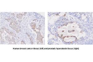 Paraffin embedded sections of human breast cancer and prostate hyperplasia tissue were incubated with anti-human STEAP1 (1:50) for 2 hours at room temperature. (STEAP1 抗体  (AA 1-70))