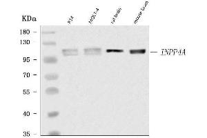 Western blot analysis of INPP4A using anti-INPP4A antibody (ABIN7601587).