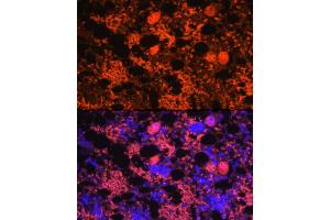 Immunofluorescence analysis of rat bone marrow using CXCL4/PF4 Rabbit pAb (ABIN7269400) at dilution of 1:100 (40x lens). (PF4 抗体)