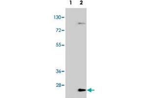 Western blot analysis of UBE2H (arrow) using UBE2H polyclonal antibody . (UBE2H 抗体  (C-Term))