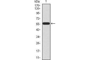 Western blot analysis using HOXA9 mAb against human HOXA9 (AA: 1-272) recombinant protein.