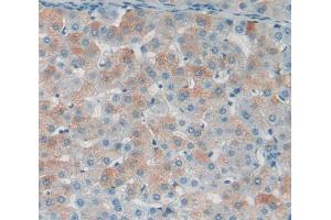 Immunohistochemistry (IHC) image for anti-CD40 Ligand (CD40LG) (AA 50-243) antibody (ABIN1862301)