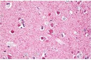 Immunohistochemistry (Paraffin-embedded Sections) (IHC (p)) image for anti-Ribosomal Protein S6 Kinase, 90kDa, Polypeptide 5 (RPS6KA5) (Internal Region) antibody (ABIN1449449)