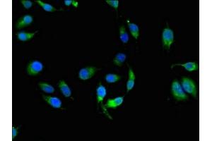 Immunofluorescent analysis of Hela cells using ABIN7155625 at dilution of 1:100