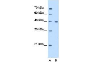 Enolase 3 antibody used at 5 ug/ml to detect target protein. (ENO3 抗体)