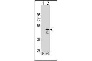 Western blot analysis of OLA1 (arrow) using GTPBP9 / OLA1 Antibody (N-term) Cat. (OLA1 抗体  (N-Term))