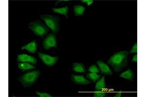 Immunofluorescence of monoclonal antibody to TXN on HeLa cell. (TXN 抗体  (AA 1-105))