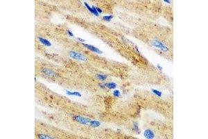 Immunohistochemical analysis of Epsilon-sarcoglycan staining in mouse heart formalin fixed paraffin embedded tissue section. (SGCE 抗体)
