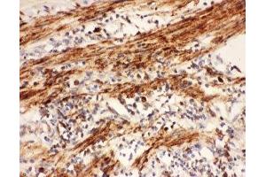 Immunohistochemistry (IHC) image for anti-Cytochrome C Oxidase Subunit I (COX1) (AA 318-599) antibody (ABIN3030661)