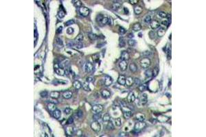 Image no. 1 for anti-Eukaryotic Translation Initiation Factor 4E Family Member 2 (EIF4E2) (N-Term) antibody (ABIN357298) (EIF4E2 抗体  (N-Term))