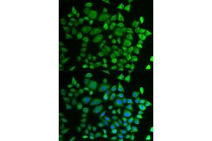 Immunofluorescence analysis of HeLa cells using P4HTM antibody (ABIN6292983). (P4HTM 抗体)