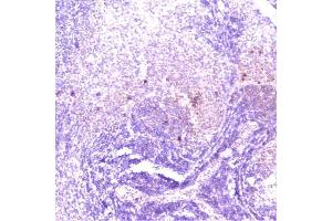 IHC analysis of TANK using anti-TANK antibody (ABIN6719508). (TANK 抗体)