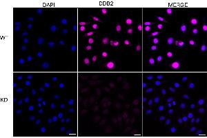 Immunocytochemical staining of HeLa cells using DDB2 antibody (ABIN7798274), 1:1,000), Top panel: wild-type (WT), Bottom panal: DDB2 shRNA knockdown (KD). (Recombinant DDB2 抗体)
