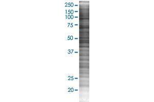 CLP1 transfected lysate. (HEAB 293T Cell Transient Overexpression Lysate(Denatured))