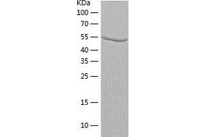 Alanine Aminotransferase (ALT) (AA 1-496) protein (His-IF2DI Tag)
