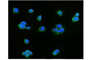IF analysis of AIF using anti-AIF antibody (ABIN3043779).