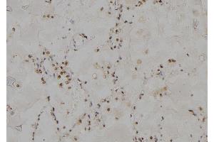ABIN6277000 at 1/100 staining Human lung tissue by IHC-P. (PSMC3 抗体)