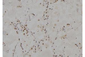 ABIN6277000 at 1/100 staining Human lung tissue by IHC-P.