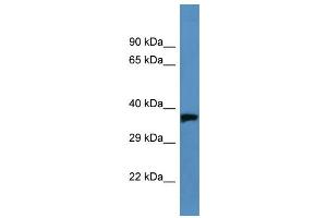 Western Blotting (WB) image for anti-Opsin 1 (Cone Pigments), Medium-Wave-Sensitive (OPN1MW) (C-Term) antibody (ABIN2788201) (OPN1MW 抗体  (C-Term))
