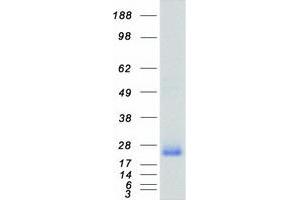 Western Blotting (WB) image for Ras Homolog Gene Family, Member A (RHOA) protein (Myc-DYKDDDDK Tag) (ABIN2730844)
