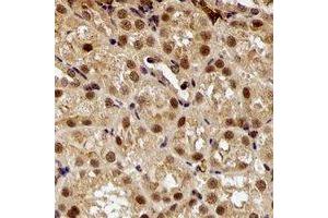 Immunohistochemical analysis of E6AP staining in rat kidney formalin fixed paraffin embedded tissue section. (ube3a 抗体)
