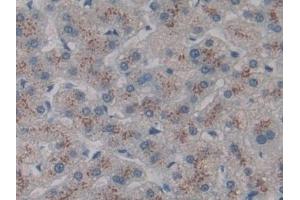 Immunohistochemistry (IHC) image for anti-C-Type Lectin Domain Family 10, Member A (CLEC10A) (AA 71-239) antibody (ABIN7441910)