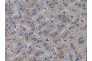 Detection of CD301 in Human Liver Tissue using Polyclonal Antibody to Cluster Of differentiation 301 (CD301) (CLEC10A 抗体  (AA 71-239))