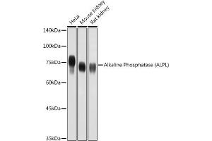 Western blot analysis of extracts of various cell lines, using Alkaline Phosphatase (ALPL) antibody (ABIN3021385, ABIN3021386, ABIN1512569 and ABIN6214987) at 1:1000 dilution. (ALPL 抗体  (AA 20-270))