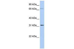 IDI1 antibody used at 1 ug/ml to detect target protein. (IDI1 抗体  (Middle Region))