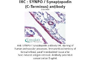 Image no. 2 for anti-Synaptopodin (SYNPO) (C-Term) antibody (ABIN1739830) (SYNPO 抗体  (C-Term))