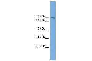 UTP14A antibody used at 1 ug/ml to detect target protein. (UTP14A 抗体)