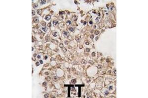 Immunohistochemistry (IHC) image for anti-G Protein-Coupled Receptor Kinase 4 (GRK4) antibody (ABIN3002926) (GRK4 抗体)