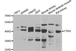 Western blot analysis of extracts of various cell lines, using CTNS antibody. (CTNS 抗体)