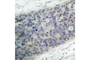 Immunohistochemistry (IHC) image for anti-LIM Domain Kinase 2 (LIMK2) (pThr505) antibody (ABIN3020313) (LIMK2 抗体  (pThr505))