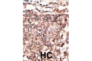 Immunohistochemistry (IHC) image for anti-Platelet Derived Growth Factor D (PDGFD) antibody (ABIN3002574) (PDGFD 抗体)