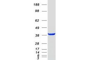 Western Blotting (WB) image for GDP-Mannose Pyrophosphorylase B (GMPPB) (Transcript Variant 2) protein (Myc-DYKDDDDK Tag) (ABIN2722093)